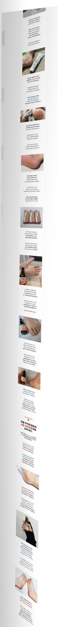 요즘 발 상태
