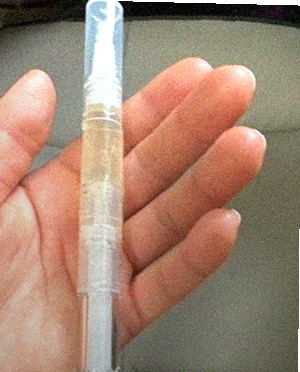 손 상태