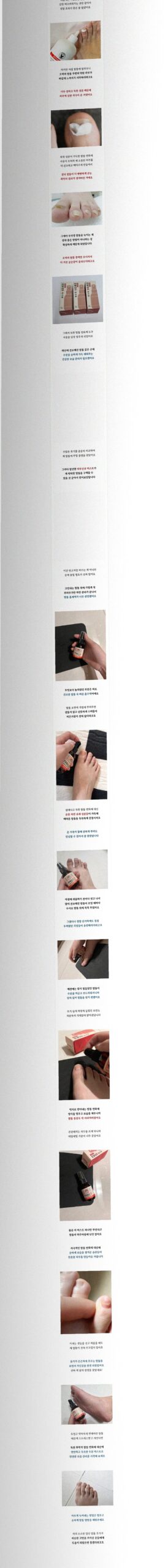 요즘 발 상태