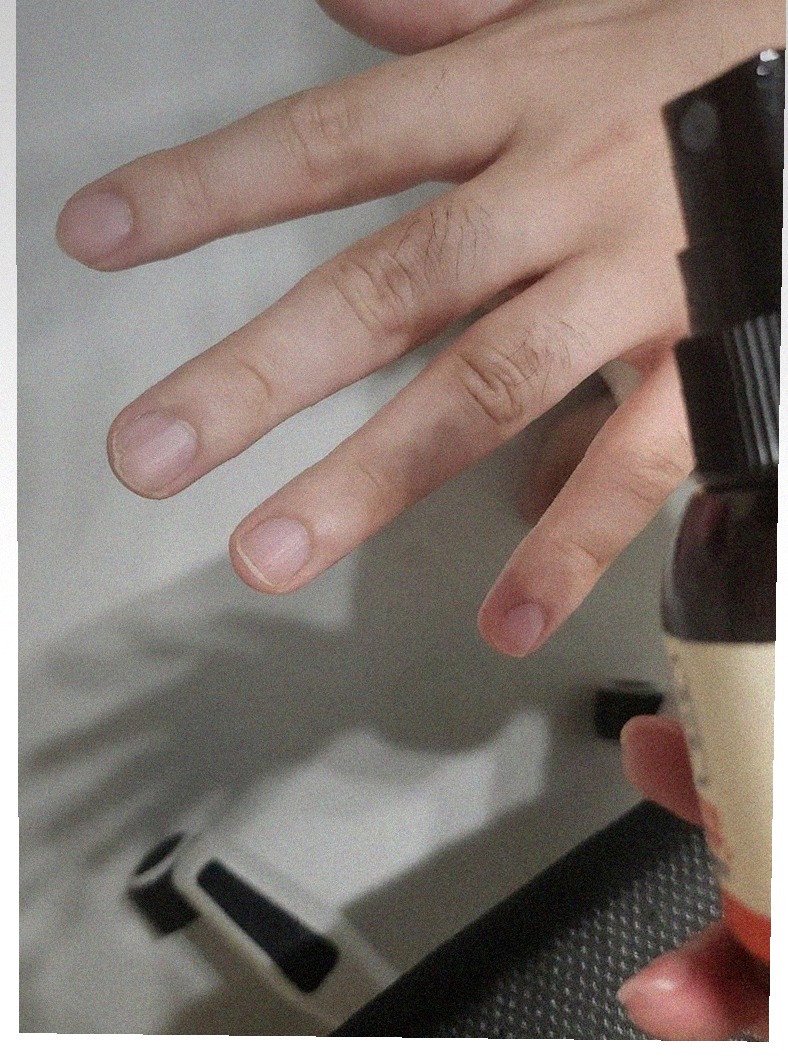손 상태